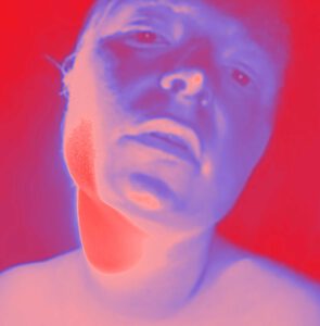 Roter Fleck