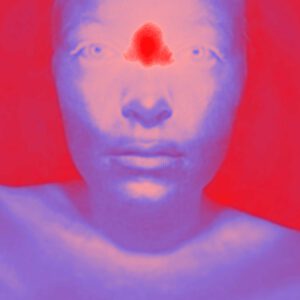 Roter Fleck