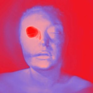 Roter Fleck